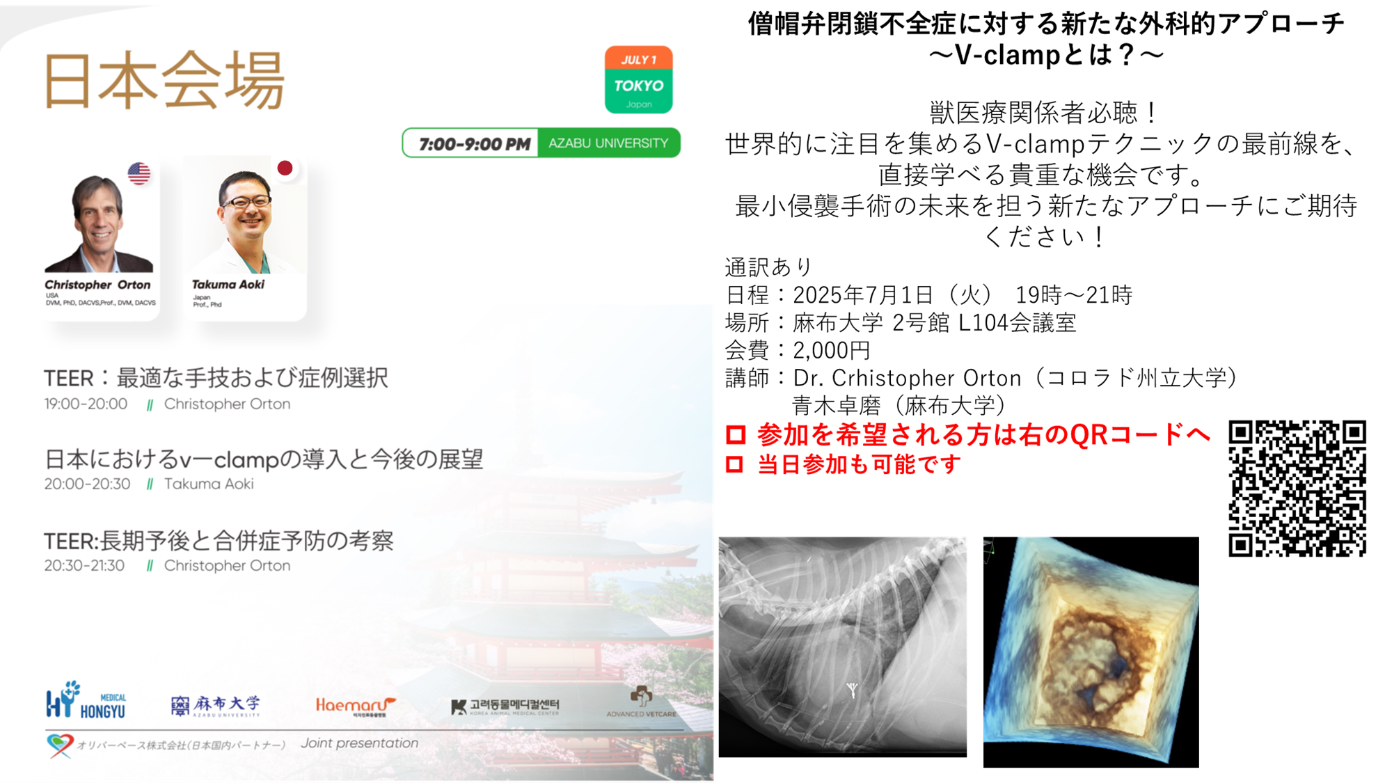僧帽弁閉鎖不全症セミナー.png